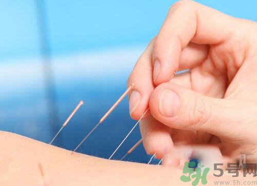 埋線減肥多少錢(qián)一次？埋線減肥的副作用