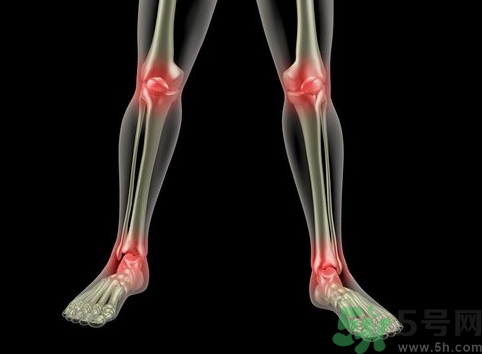 下雨天關(guān)節(jié)痛是怎么回事？下雨天關(guān)節(jié)疼痛是風(fēng)濕性關(guān)節(jié)炎嗎？