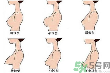 ?女性乳房下垂的原因是什么？女性乳房下垂的分類有哪些？