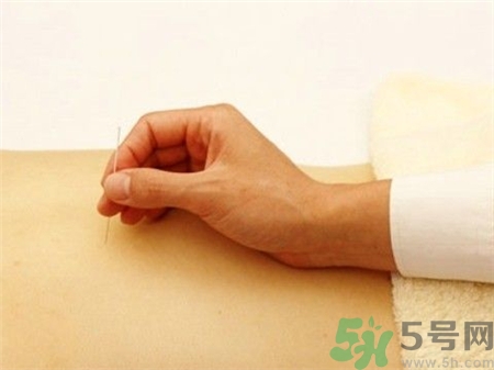 針灸后能游泳嗎?針灸游泳會(huì)怎么樣? 針灸后能游泳嗎?針灸游泳會(huì)怎么樣?