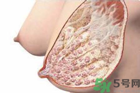 乳腺增生治療方法是什么？乳腺增生的檢查方法有哪些？