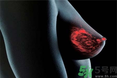 乳腺增生治療方法是什么？乳腺增生的檢查方法有哪些？