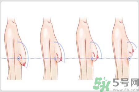 如何預防胸部松弛？吃什么能使胸部挺拔？