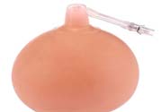 乳頭內(nèi)陷可以拔罐嗎？乳頭內(nèi)陷需要手術(shù)治療嗎？