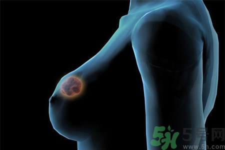 乳房屋硬塊有疼痛感怎么回事？乳房屋硬塊有疼痛感怎么辦？