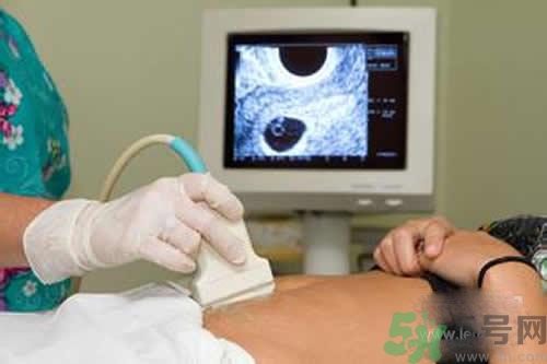 孕婦做b超要空腹嗎？孕婦做b超要不要空腹？