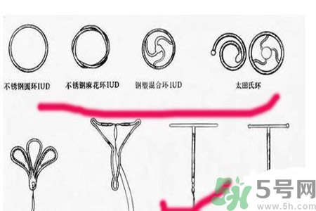 什么是宮內節(jié)育器？放置宮內節(jié)育器為什么能避孕？