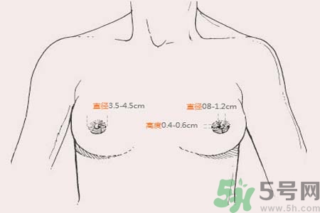 乳頭內(nèi)陷能不能喂奶？乳頭凹陷怎樣哺乳？