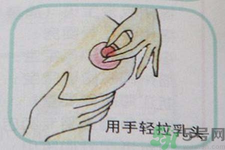 乳頭內(nèi)陷可以拔罐嗎？乳頭內(nèi)陷需要手術(shù)治療嗎？