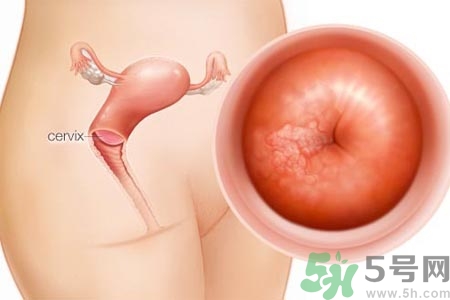 陰道干澀的原因是什么？陰道干澀怎么辦？
