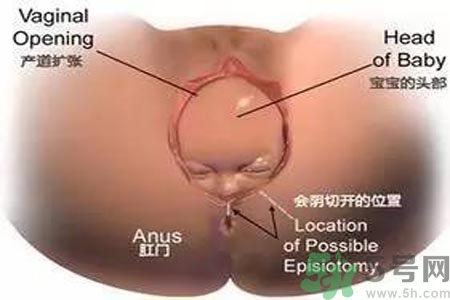 女性陰道松弛的原因是什么？女性陰道松弛怎么辦？