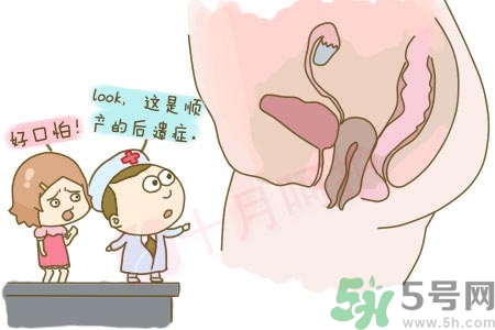 陰道松弛是什么？陰道松弛的癥狀有哪些？