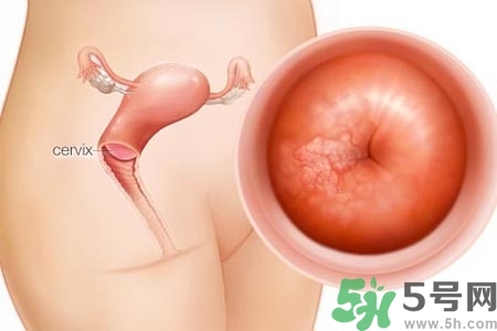 陰道出血和什么有關？陰道出血的應急措施有哪些？