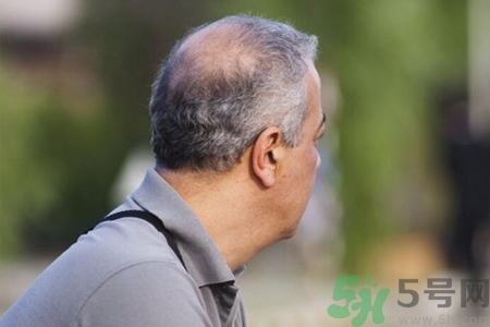 男性衰老的征兆有哪些？男性10個(gè)難以逆轉(zhuǎn)的衰老征兆