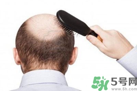 男性防止性衰老決竅有哪些？男性受用一生抵抗衰老法則
