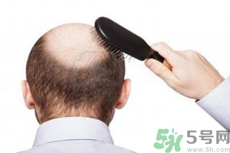 男性更年期的治療方法有哪些？如何預(yù)防男性更年期？