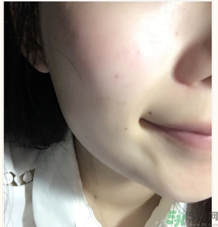 麗得姿面膜適合孕婦可以用嗎？麗得姿面膜哪些孕婦可以用？