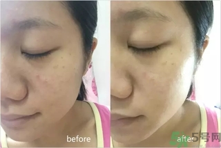 rilastil面膜使用方法 維納斯蒂爾面膜怎么用？