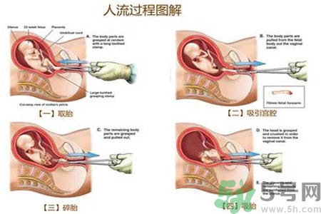 人流后怎么調(diào)養(yǎng)身體？人流后飲食需注意什么？