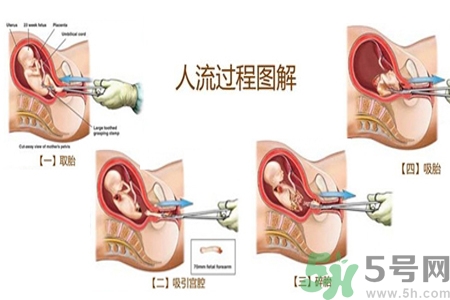 人流后怎么調(diào)養(yǎng)身體？人流后飲食需注意什么？