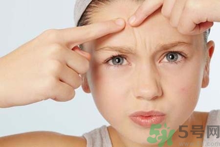 鼻翼長(zhǎng)痘痘怎么辦？鼻翼長(zhǎng)痘解決方法有哪些？