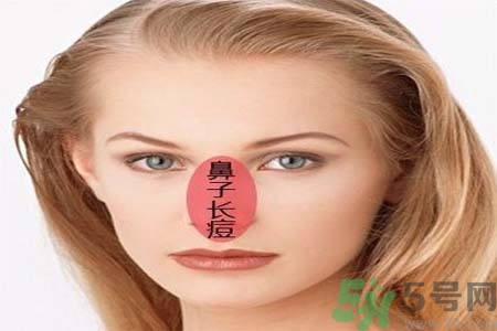 鼻子兩側(cè)長痘怎么辦？鼻子兩側(cè)長痘怎么回事？