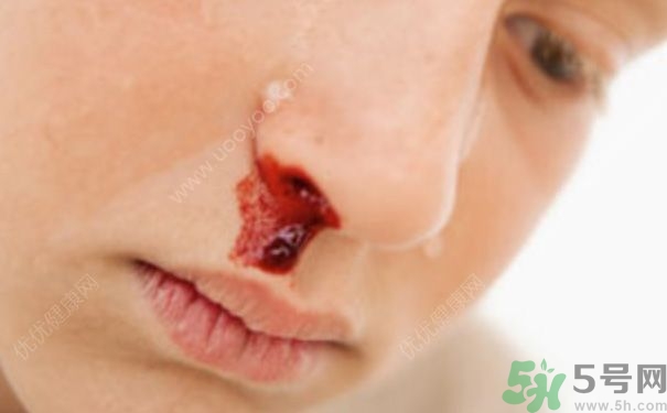 15歲男孩可以刮胡子嗎？15歲男孩經(jīng)常流鼻血怎么回事？