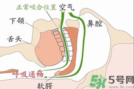 鼻子紅是什么原因？鼻子紅怎么辦？