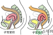 ?子宮移位怎么治療？子宮移位能懷孕嗎？
