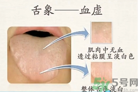 血虛怎么調(diào)理？女人血虛怎么調(diào)理？