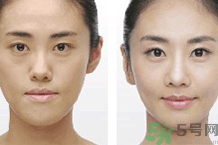 激光縮毛孔多少錢一次？激光縮毛孔一個(gè)療程多少錢？