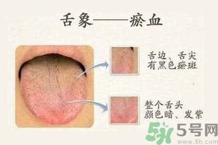 血瘀體質(zhì)吃什么？血瘀體質(zhì)怎么調(diào)理？