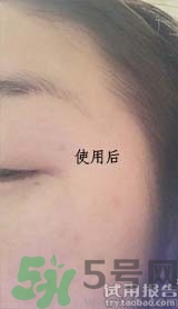 dr.jart適合什么年齡層？蒂佳婷適合年齡