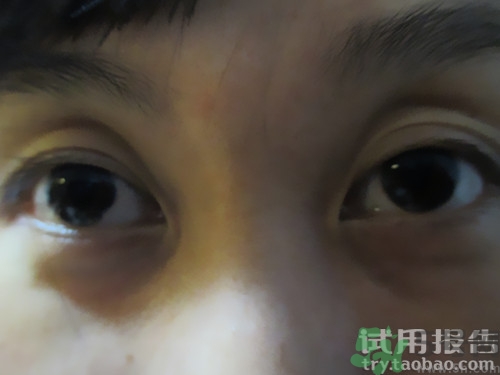 蛇毒眼膜效果怎么樣？spa蛇毒眼膜紅色好用嗎？