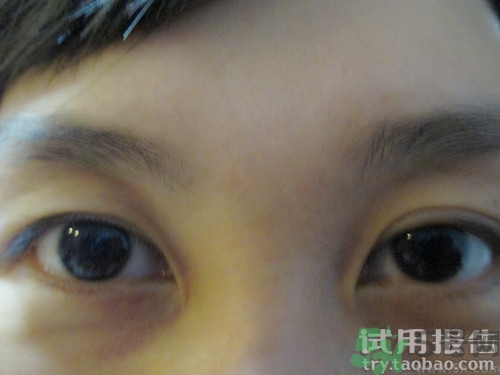 蛇毒眼膜效果怎么樣？spa蛇毒眼膜紅色好用嗎？