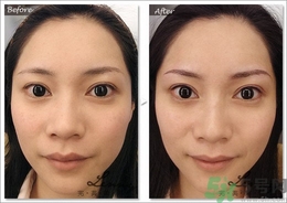 眉毛怎么整形好看？眉毛怎么整自然？