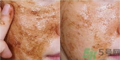 思親膚在韓國(guó)什么檔次？skin food在韓國(guó)怎么樣？