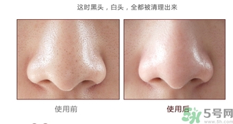 yu.r巧克力棒鼻貼怎么樣？yu.r巧克力鼻貼好用嗎？