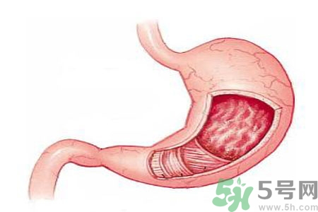 緩解胃脹的方法是什么？胃脹可以吃什么？