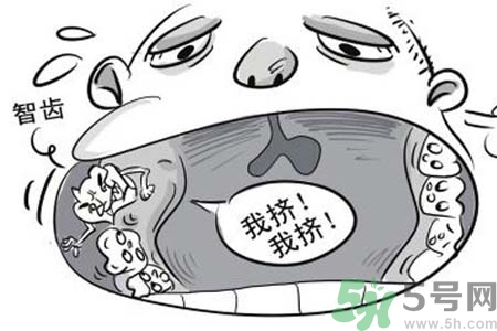 智齒一定要拔掉嗎？什么樣的智齒可以不拔？