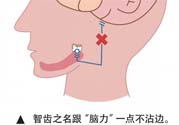 長智齒疼痛怎么辦？長智齒牙齦腫了怎么辦？