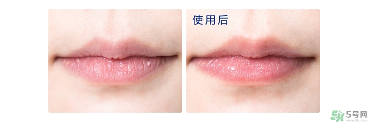 碧唇小藍(lán)罐唇膏孕婦可以用嗎？blistex碧唇小藍(lán)罐專柜價格