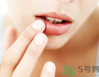 孕婦嘴唇干裂脫皮怎么回事？孕婦嘴唇干裂脫皮是缺什么