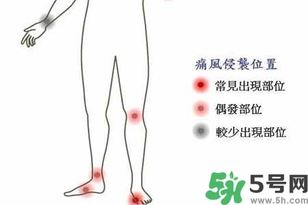 引發(fā)痛風的原因是什么？痛風病人飲食需注意什么好？