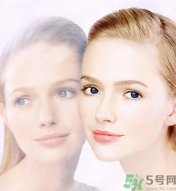 曬斑可以自己消退嗎？曬斑可以用激光去除嗎？