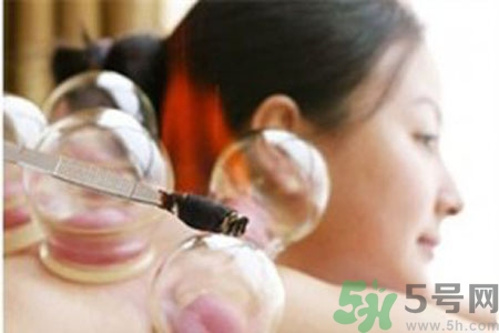 肩膀酸痛可以拔火罐嗎？孕婦肩膀酸痛能拔火罐嗎？