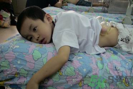 小孩可以拔罐嗎？寶寶能拔火罐嗎？