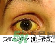 上腹部不舒服有時疼痛會不會是胰臟癌？