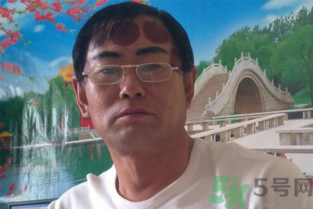 頭痛可以在額頭上拔火罐嗎？額頭上拔火罐有什么好處？