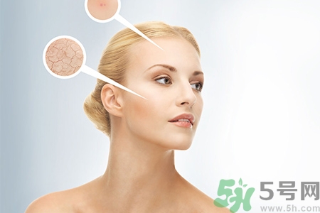 甘油會(huì)堵塞毛孔嗎？甘油堵塞毛孔怎么辦？